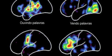 Linguagem e cérebro: confira as principais áreas ativadas