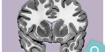 Redes neurais: a anatomia da substância branca cerebral