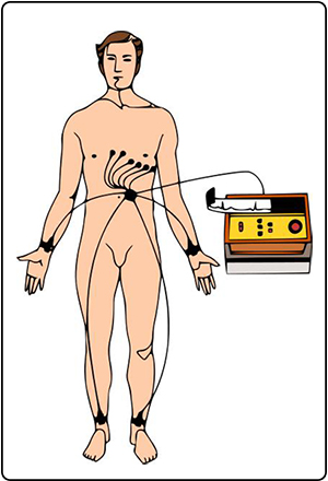 desmaio-eletrocardiograma-ECG