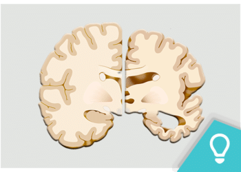 Alzheimer: as lesões cerebrais predominantes e os genes envolvidos