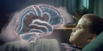 Espaços aumentados em cérebros infantis foram associados a um maior risco de autismo e distúrbios do sono