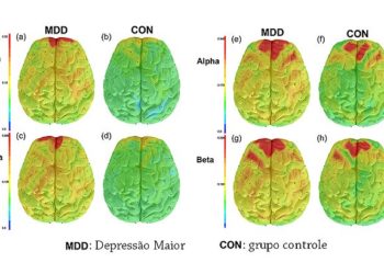 depressao redes neurais