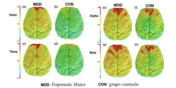 depressao redes neurais
