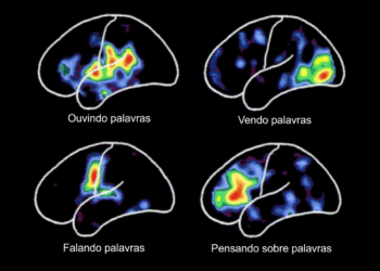 Linguagem e cérebro: confira as principais áreas ativadas