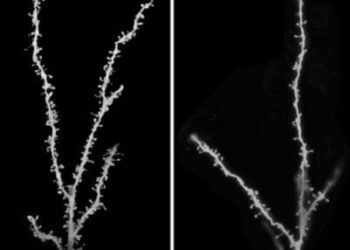 Sinapses no autismo: o cérebro autista têm um excesso de conexões?